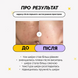 Medicube AGE-R Booster Pro Mini White Міні-пристрій для домашнього догляду за шкірою 8800256114740 фото 3